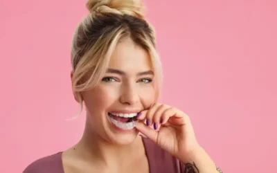 Avis Dr. Smile: Découvrez l’efficacité et le confort des aligneurs dentaires